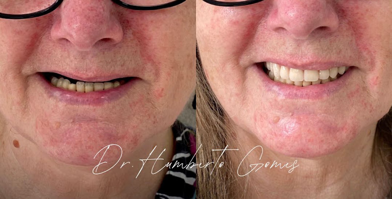Foto 3 de HG Dental – Implantes e Estética