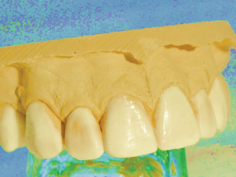 Foto de Higaki Odontologia - Implantes Dentários