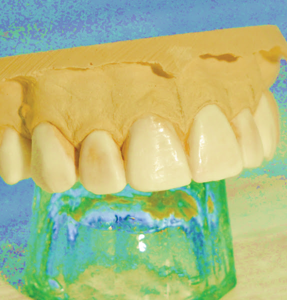 Foto 2 de Higaki Odontologia - Implantes Dentários