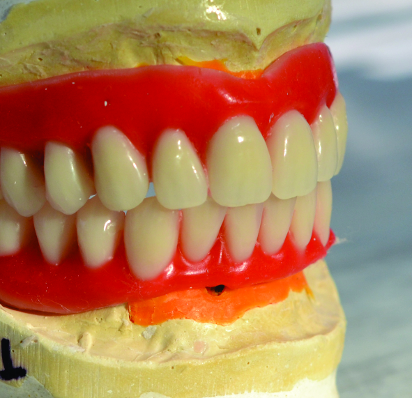 Foto 3 de Higaki Odontologia - Implantes Dentários