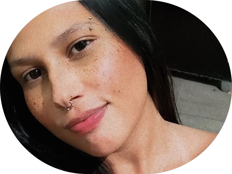 Foto 3 de HOF Time - Montes Claros | Harmonização Facial | Botox | Preenchimento Labial | Radiesse | Sculptra | Rinomodelação
