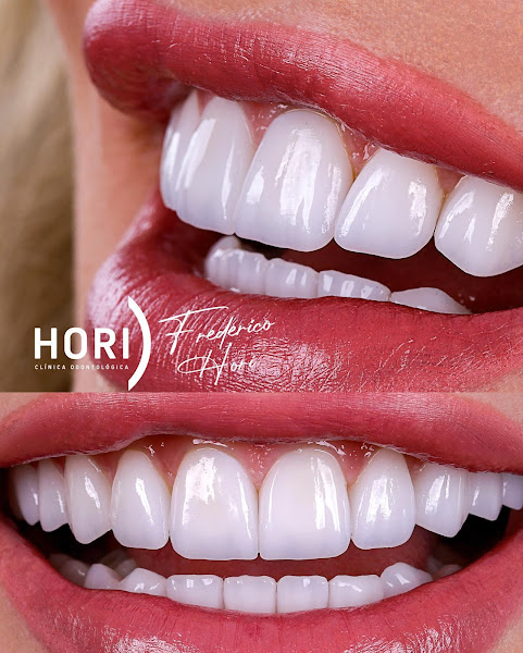 Foto 3 de Hori Clínica Odontológica