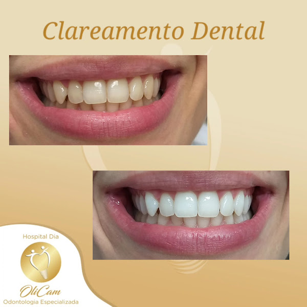 Foto 4 de Hospital Dia OliCam Odontologia Especializada - Dra Flavia S O Campos - Dr Nilton Campos Jr