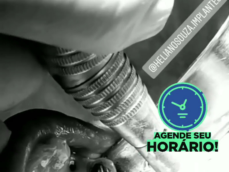 Foto 8 de Hospital Dia OliCam Odontologia Especializada - Dra Flavia S O Campos - Dr Nilton Campos Jr