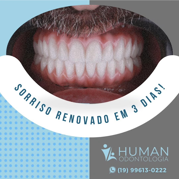 Foto 2 de Human Odontologia