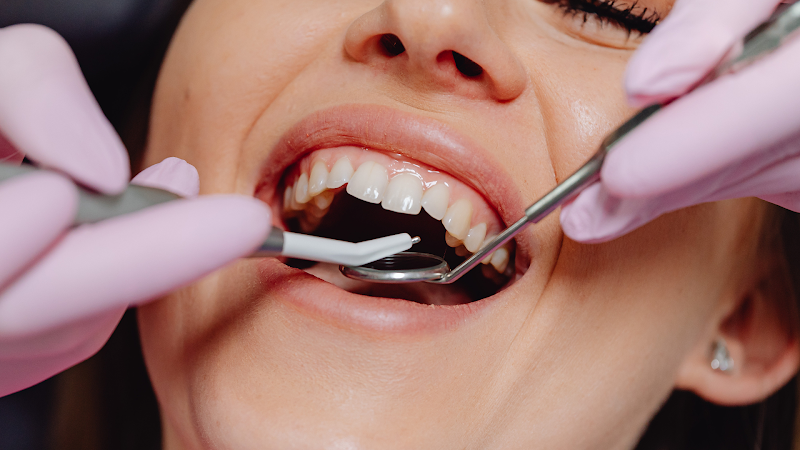 Foto 3 de Humanize Odontologia | Dentistas ABC, Clareamento Dental, Implante, Prótese, Tratamento de Canal, Extração Siso