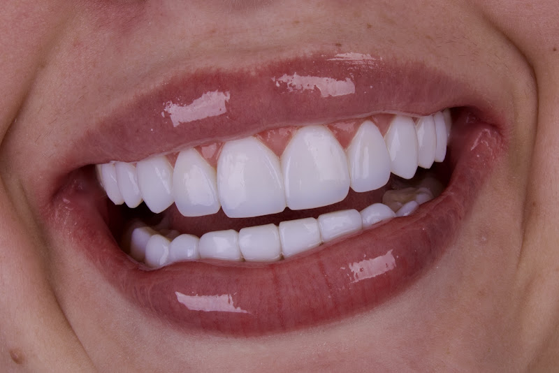 Foto 2 de Hype Odontologia