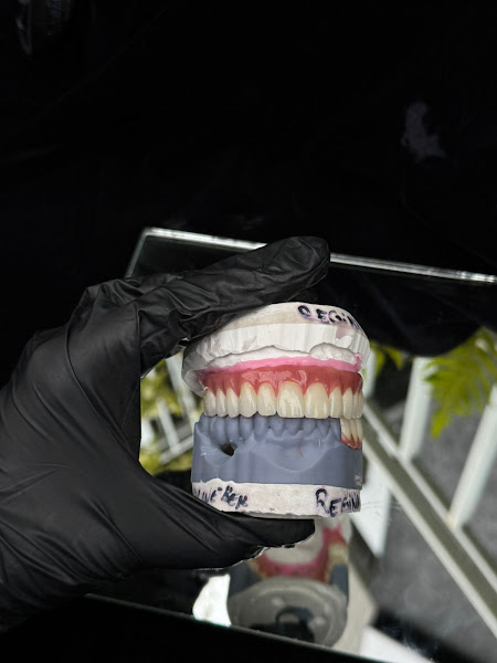 Foto 2 de Hyperlab Laboratório de Próteses Dentárias