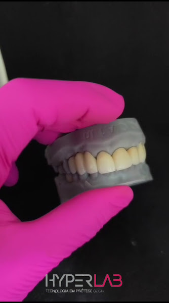 Foto 3 de Hyperlab Laboratório de Próteses Dentárias