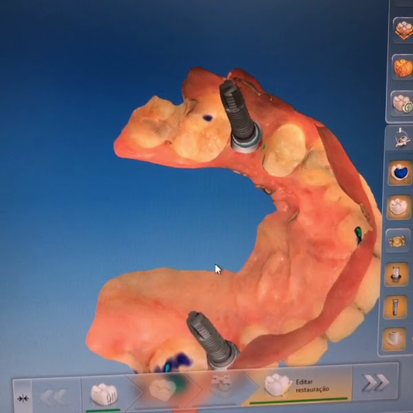 Foto 3 de I A N - Odontologia - Instituto Álvaro Nogueira - Vila Pinto