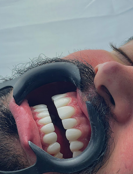 Foto 3 de I.Odonto Saúde