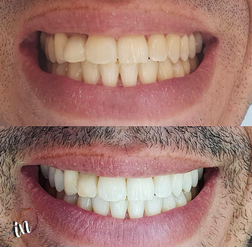 Foto 2 de Iana Nádila