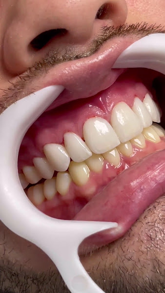 Foto 4 de Ianara Pinho Odontologia