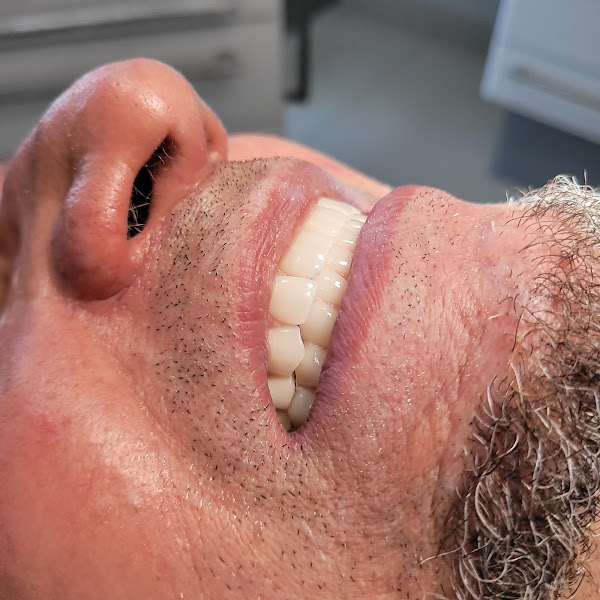 Foto 3 de iBC - Instituto Balbi Costa de odontologia - Implantodontia e estética | Harmonização Facial