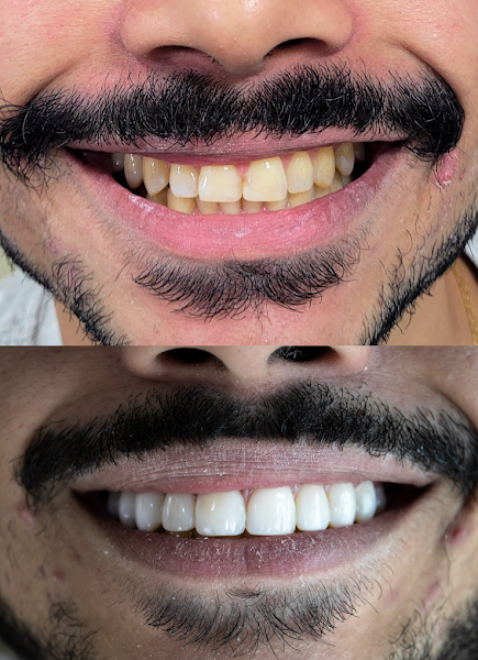 Foto 2 de iBC ODONTO Barra