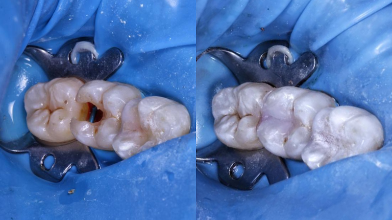 Foto 3 de IBO Dental Clinic