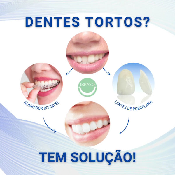 Foto 3 de IBRASO - Instituto Brasileiro de Saúde Oral