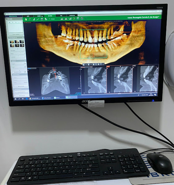 Foto 2 de Ibro Odontologia Diagnóstica