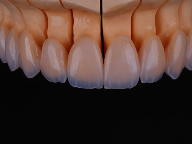 Foto 3 de Ideal Prótese | Laboratório de prótese dentária em Goiânia