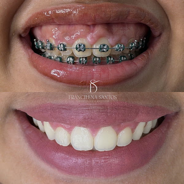 Foto 3 de Ideal Sorriso (dentista)