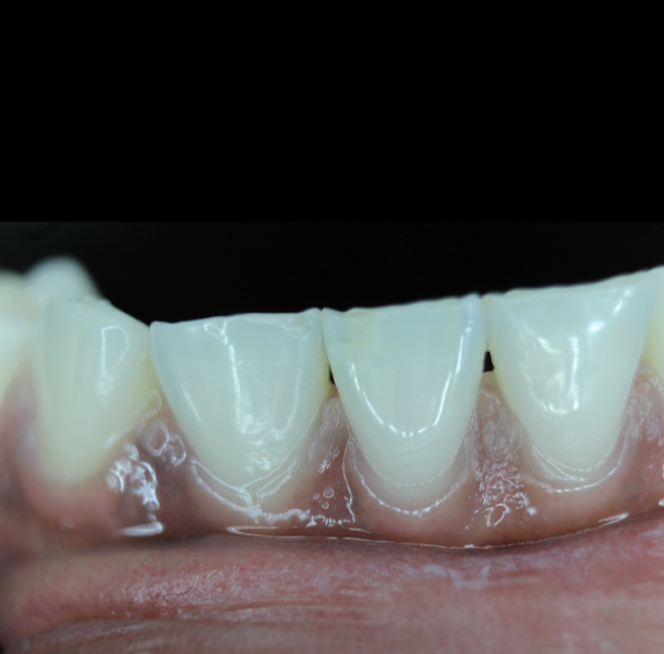 Foto 2 de Ideale Cirurgia Bucomaxilo e Implantes