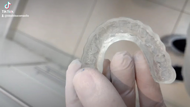 Foto 3 de Ideale Cirurgia Bucomaxilo e Implantes