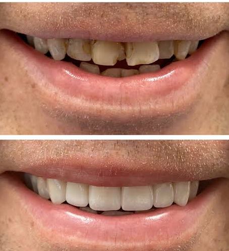 Foto 2 de Idealize Sorrisos