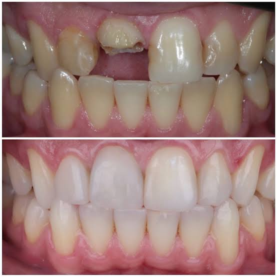 Foto 3 de Idealize Sorrisos