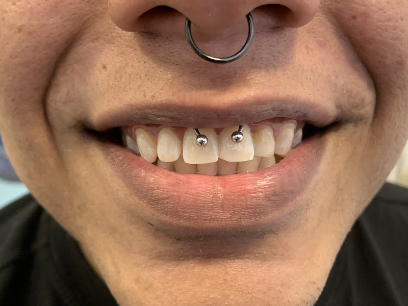 Foto 6 de Idealize Sorrisos