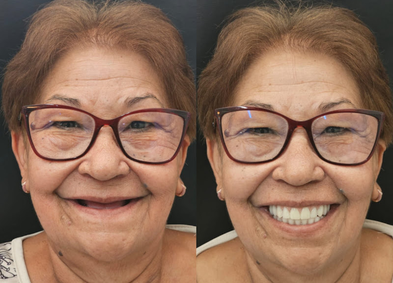 Foto 3 de Idealle Odontologia| Dentista Bela Vista| Implante| Canal| Aparelho Ortodôntico| Alinhadores| Facetas