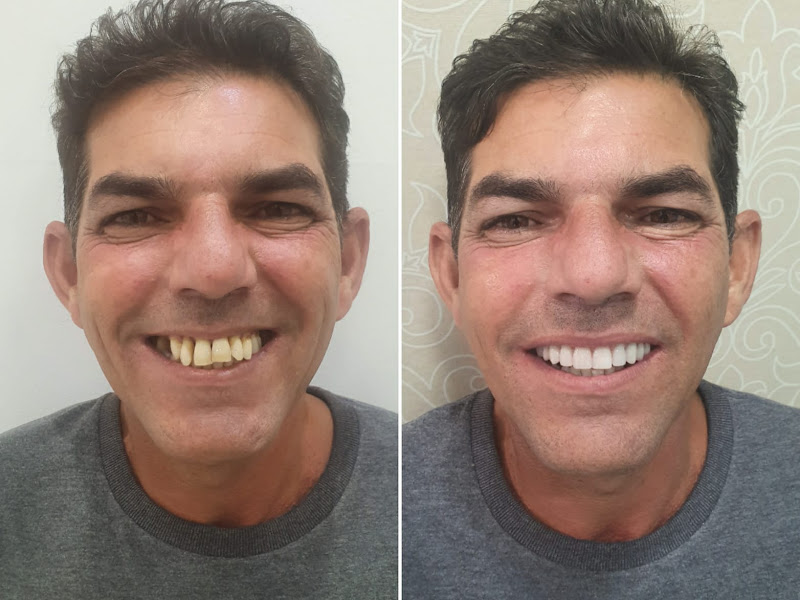 Foto 10 de Idealle Odontologia| Dentista Bela Vista| Implante| Canal| Aparelho Ortodôntico| Alinhadores| Facetas