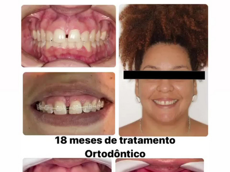 Foto de Idealy Odontologia Salvador