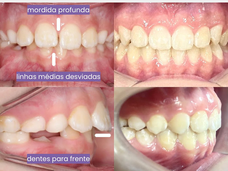Foto 3 de IDOF Instituto de Dor Orofacial