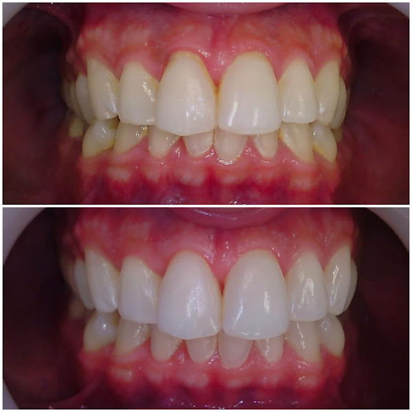 Foto 3 de IE odontologia Sorriso&Face