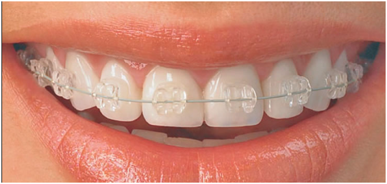 Foto 2 de IEB CENTRO - CLÍNICA ODONTOLÓGICA (DENTISTA GOVERNADOR VALADARES)