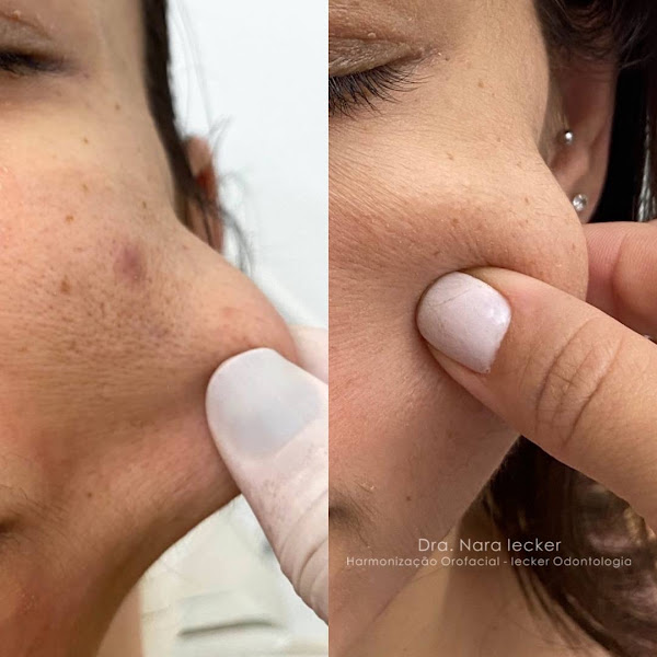 Foto 3 de Iecker Odontologia e Estética Facial
