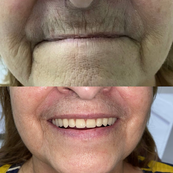 Foto 3 de IERO Odontologia