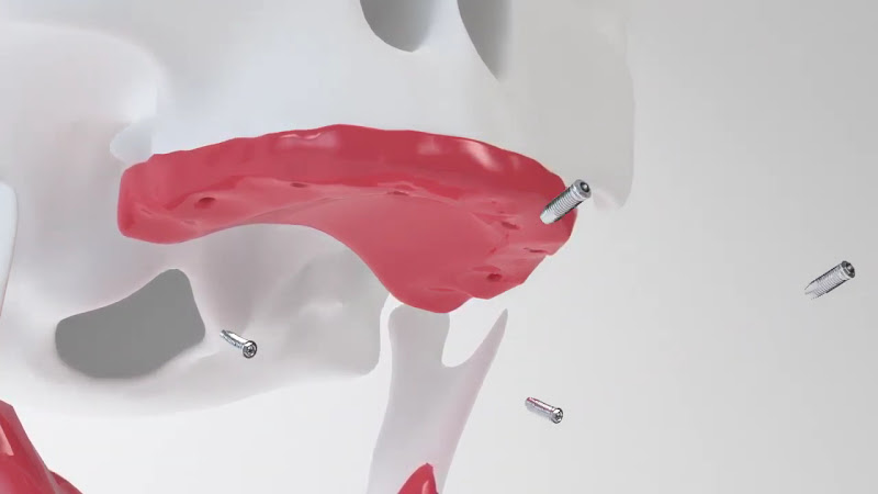 Foto 4 de IGO - Instituto Guskuma de Odontologia - Curitiba