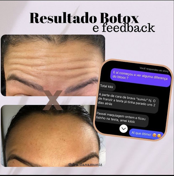 Foto de Ilana Muniz - Odontologia e Harmonização facial em Jequié - Botox, preenchimento labial, clareamento, limpeza dental
