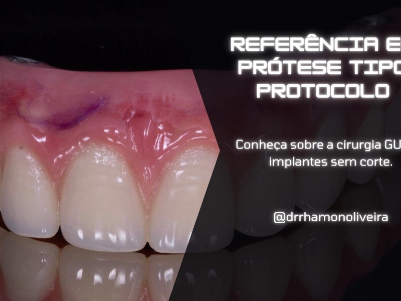 Foto 9 de Ilúmia Odontologia | Serra