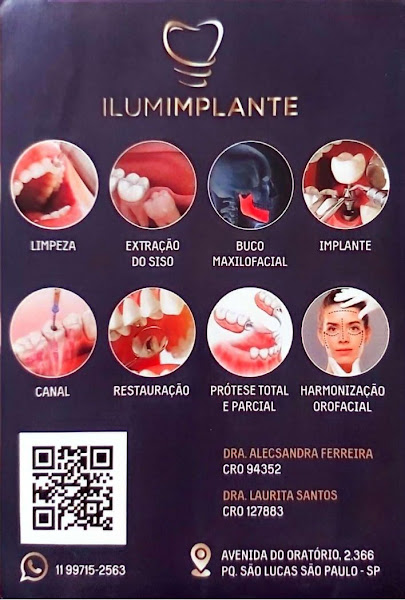 Foto 2 de Ilumimplante Clínica Odontológica - Implante Dentário - Remoção de siso / dente