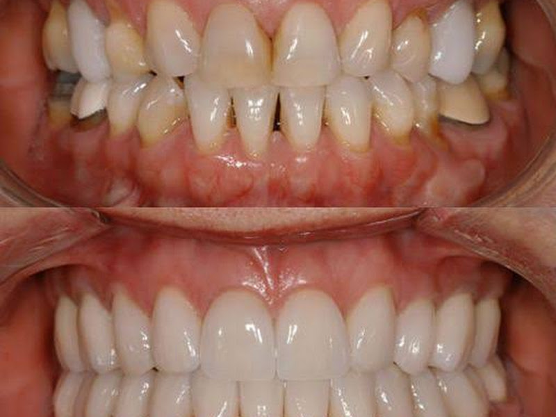 Foto 9 de Iluminatti Odontologia Especializada - Endodontia| Odontopediatria| Ortodontia| Periodontia| Implante em Feira de Santana