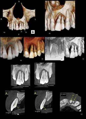 Foto 3 de Image Diagnóstico Odontológico Por Imagem