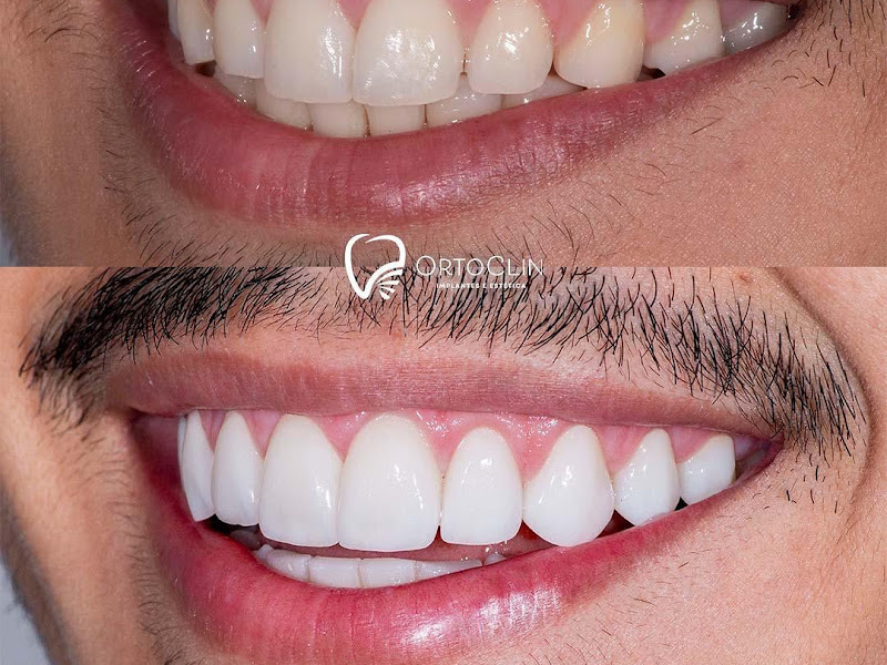 Foto 2 de Imbriani Odontologia