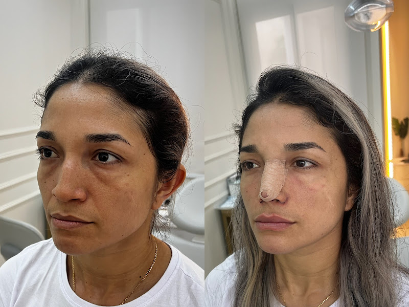 Foto 3 de Império da Harmonização - Dr Gustavo Rossi