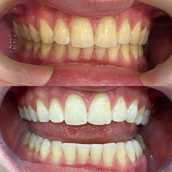 Foto 2 de Imperium Odontologia
