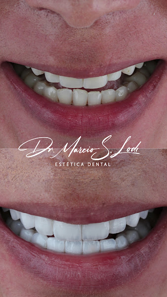 Foto 4 de Implacenter Odonto