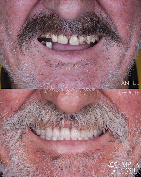 Foto 3 de ImplaMaster Odontologia