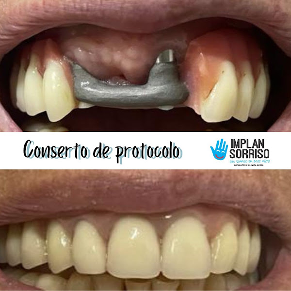 Foto 2 de Implan Sorriso