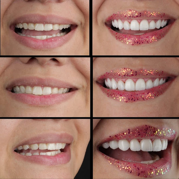 Foto 3 de Implant'Art Clínica Odontológica Macaé